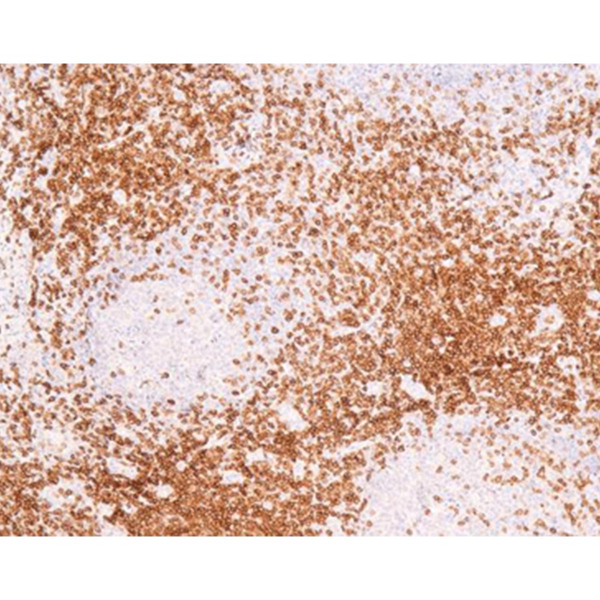CD3 | Azer Scientific